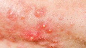 Homepage 32 Polyworking 6